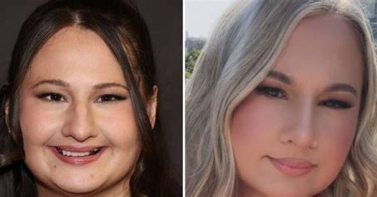 A Comprehensive Guide to Her Nose Transformation