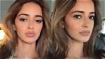 Alanna Panday Lip Filler Explored