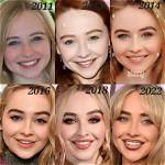 All About Sabrina Carpenter's Lip Fillers: What We Know