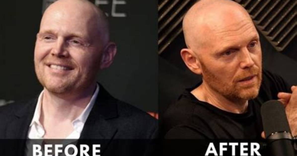 American Comedian Bill Burr Weight Loss Journey and Reasons with His Before and After Photos