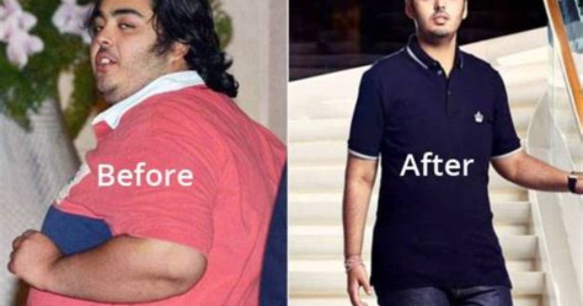 Anant Ambani's Remarkable Transformation: Before the Weight Loss Journey