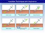 Aspirate Before Injection for Optimal Safety