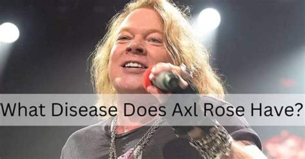 Axl Rose’s Illness, and Health Recovery 2023: How the Rock Legend Overcame Vocal Cord Damage?