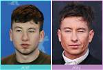 Barry Keoghan's Transformation: Exploring the Face Surgery Rumors