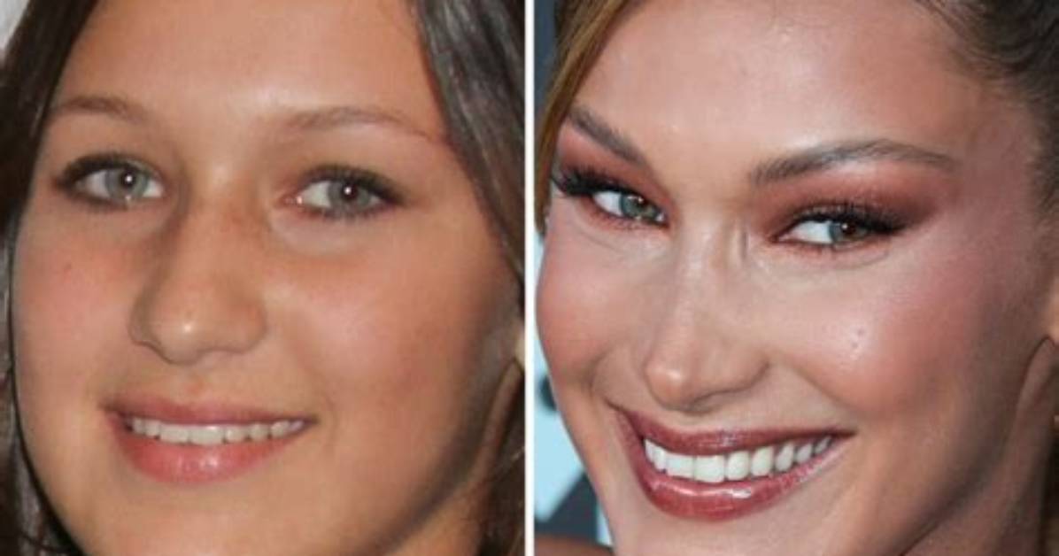 Bella Hadid: a Journey Through Transformation - Before and After