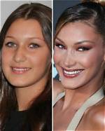 Bella Hadid: a Journey Through Transformation - Before and After