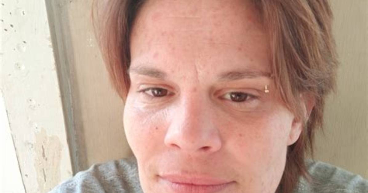 Brittany Skoland's Brave Encounter: Attacked by Dogs