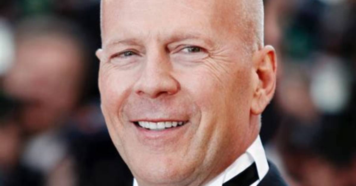 Celebrating the Iconic Bald Famous Actors