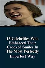Celebrities Who Embrace Their Perfectly Imperfect Smiles