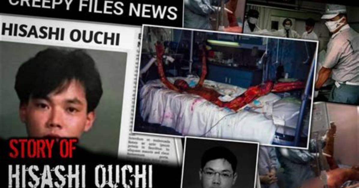 Could Hisashi Ouchi's Life Had Been Saved?