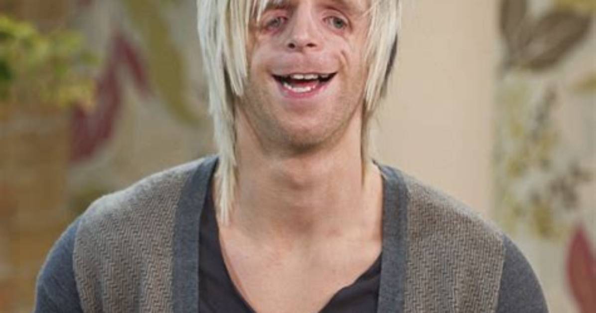 Courage and Resilience: Celebrities with Treacher Collins Syndrome