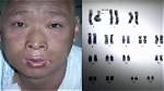 Discover Hisashi Ouchi's Skin Pictures: a Photographic Journey