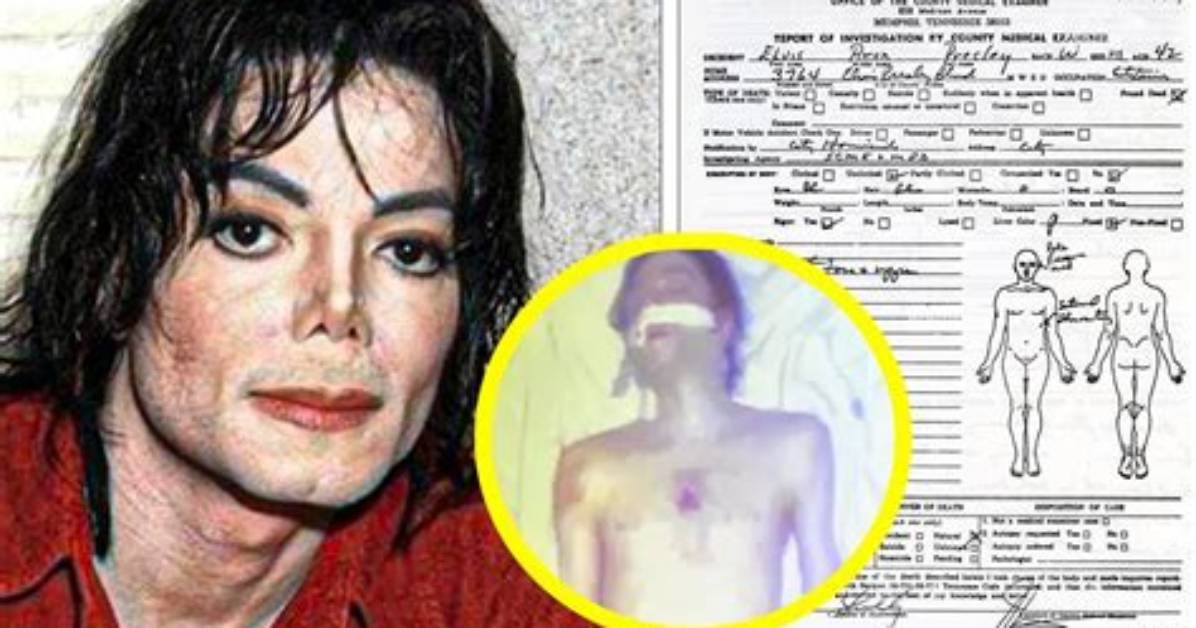 Disturbing Images: Michael Jackson's Autopsy Photos Unveiled