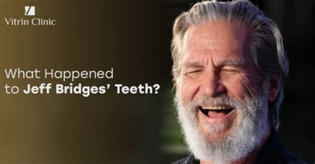 Does Jeff Bridges Wear Dentures? Fans Wonder If the Actor Actually Has Real Teeth at This Point