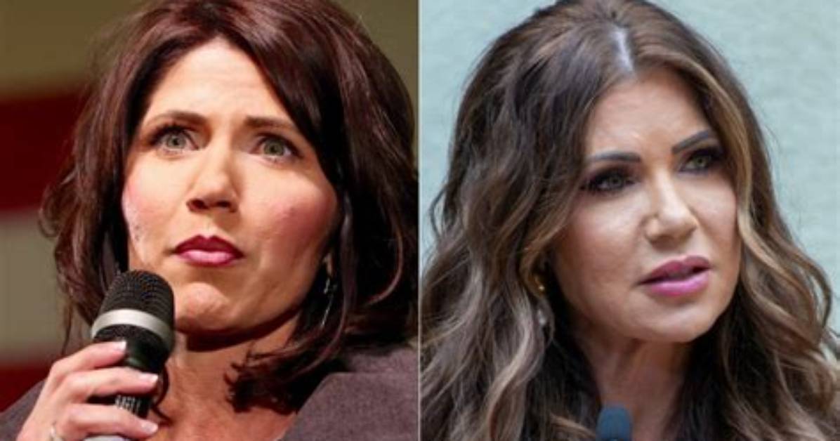Exploring Kristi Noem's Lips: the Story Behind the Politician's Look