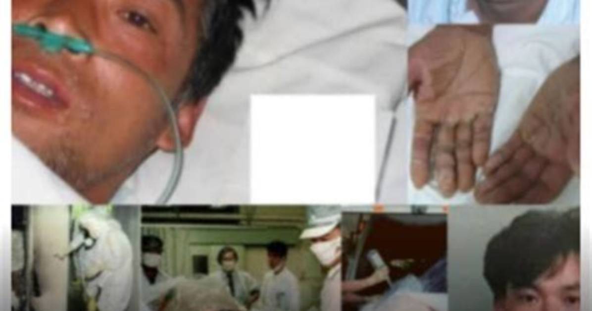 Exploring the Impact of Ouchi Radiation Pictures