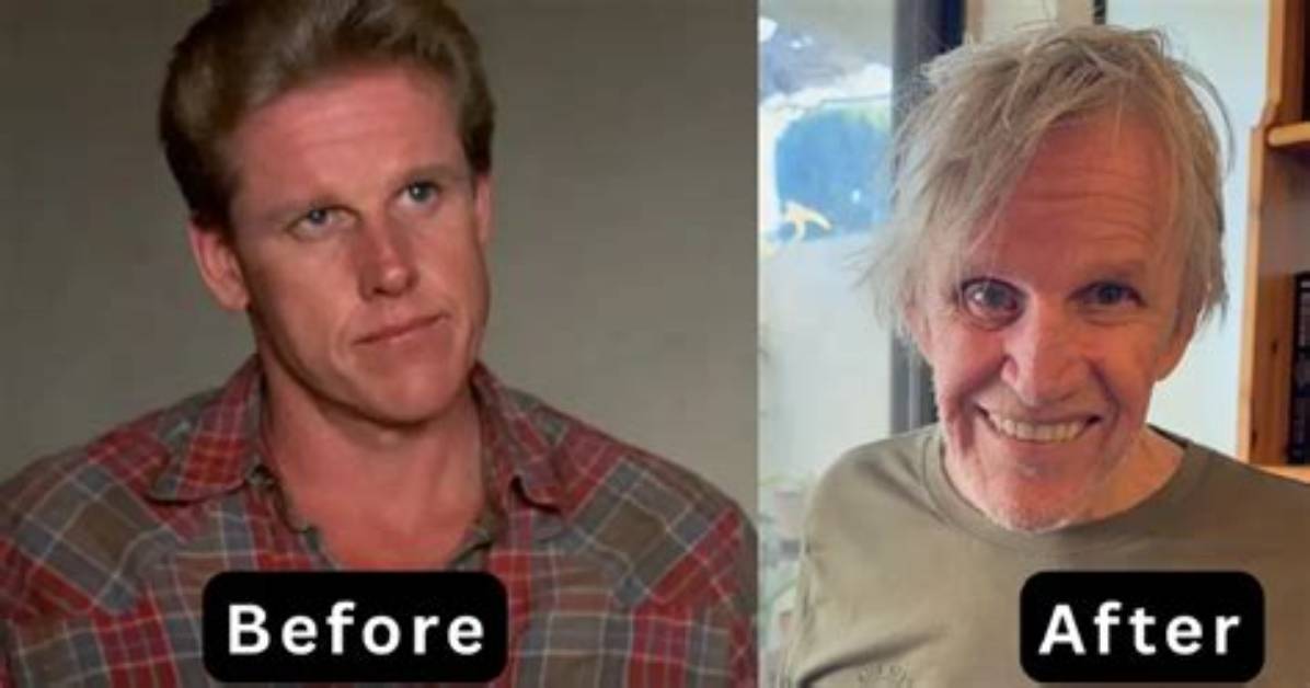 Gary Busey's Shocking Recovery: Aftermath of Tragic Accident