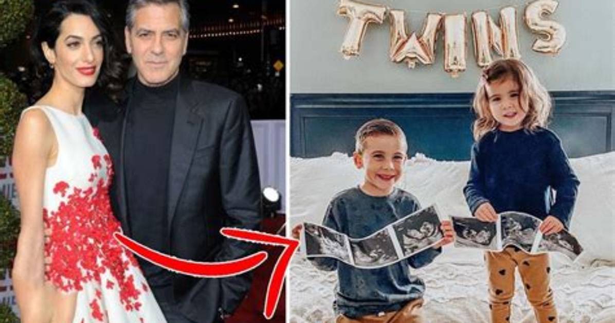 George Clooney's Twins Diagnosed with Down Syndrome