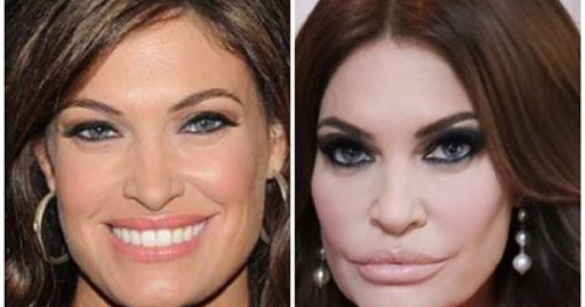 Guilfoyle Before Plastic Surgery: a Glimpse into Transformation