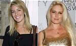 Heidi Montag's Plastic Surgery Transformation: Before and After the Knife