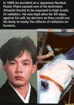 Hisashi Ouchi's Journey: the Unseen Struggles After Radiation Exposure