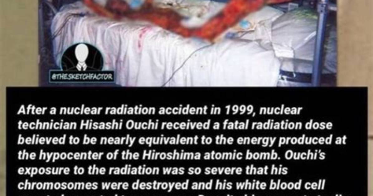 Hisashi Ouchi: the Man Behind the Radiation Image