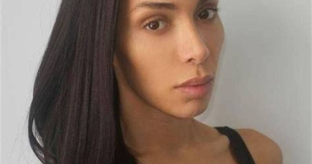 Ines Rau Plastic Surgery: Before and After Looks