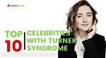 Inspiring Stories of Female Celebrities with Turner Syndrome