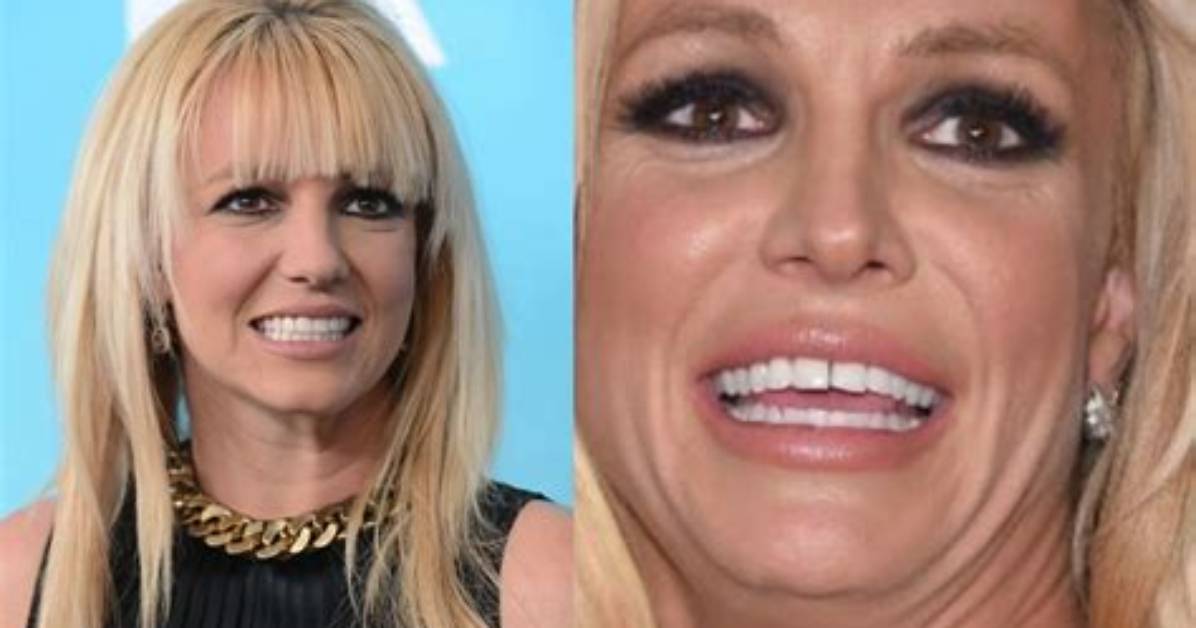 Is Britney Spears on Meth, What Happened to Her Teeth? Addiction and Condition