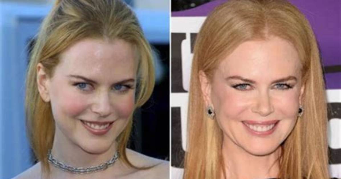 Kidman's Surgery: Details Unveiled