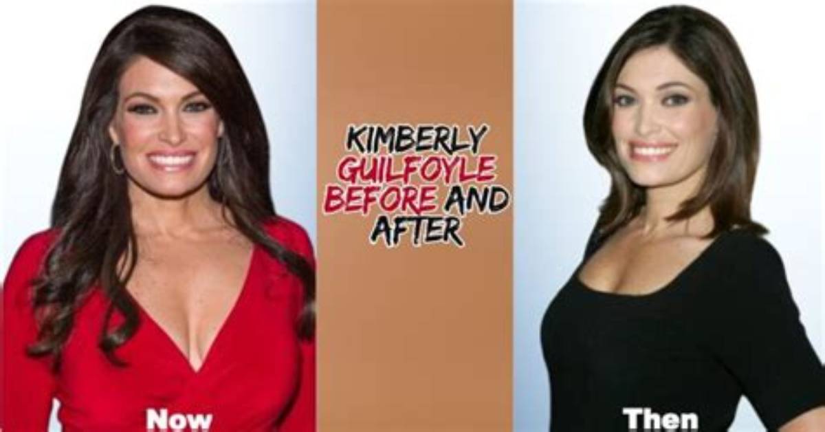 Kimberly Guilfoyle: a Journey of Transformation Before and After