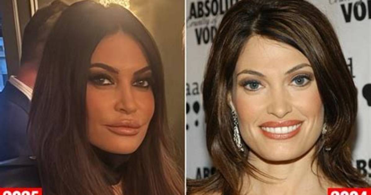Kimberly Guilfoyle: a Journey Through Pre-Surgery Transformation
