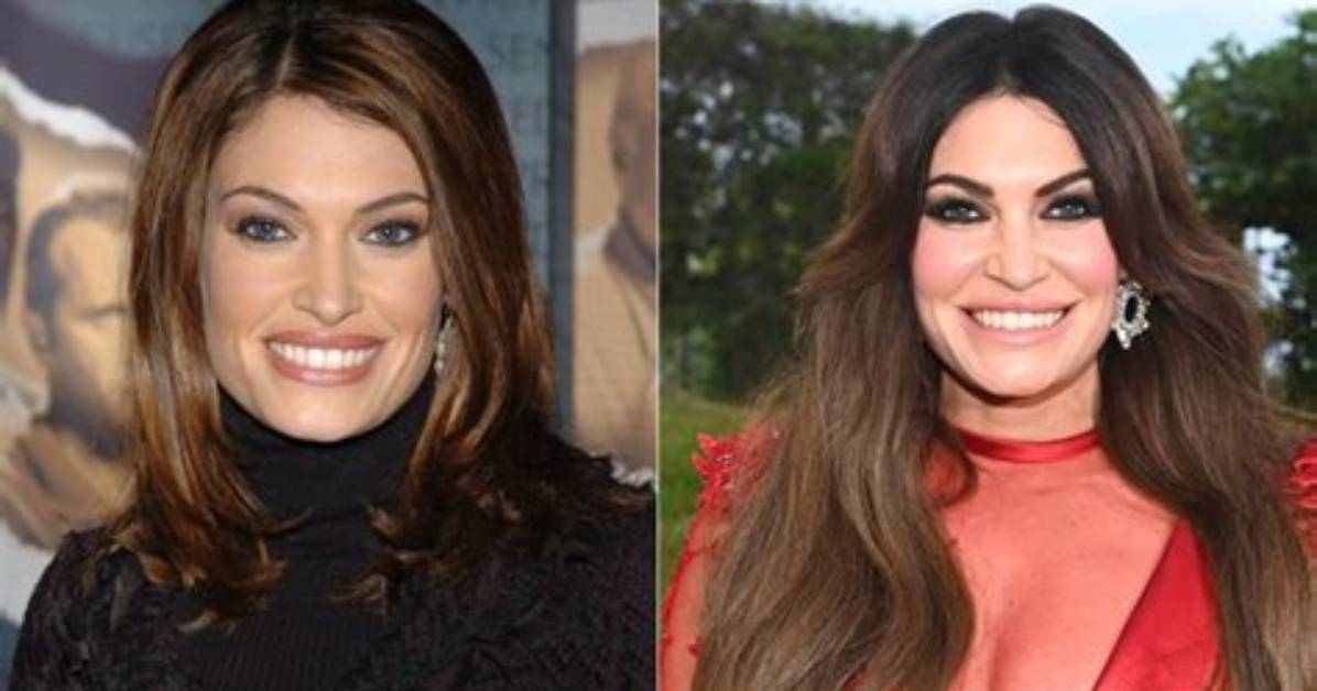 Kimberly Guilfoyle's Face Surgery: Before and After Transformation