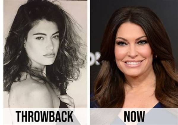 Kimberly Guilfoyle: the Transformation and Speculations Surrounding Her Face