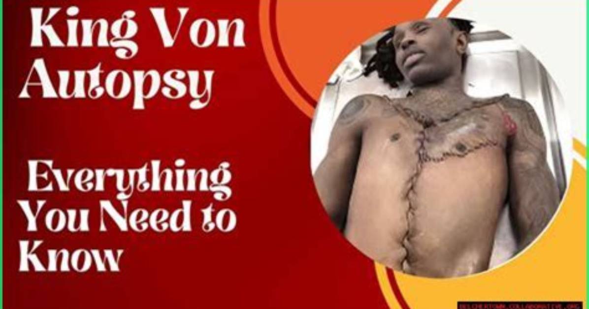 King Von Autopsy Unravels Unseen Truths