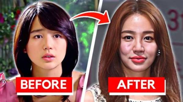 Korean Actresses Who Embraced Plastic Surgery: Transformations and Impact