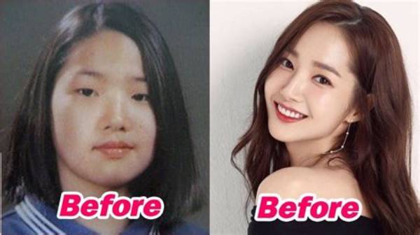 Korean Plastic Surgery Celebrity: the Transformative Journey of Beauty