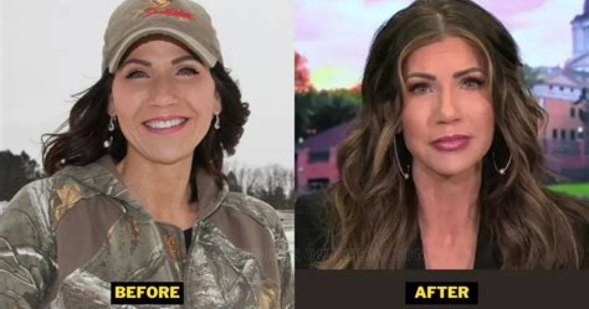 Kristi Noem's Transformation: Before and After Revealed