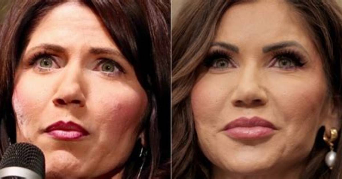 Kristie Noem's Alleged Plastic Surgery: a Comprehensive Analysis