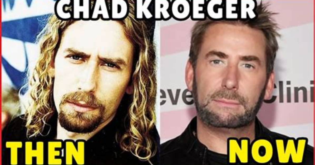Learn the Age of Chad Nickelback: Discover His True Age