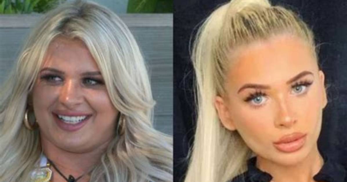 Liberty Love Island: the Transformation Before and After Surgery