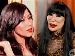 Lyn May Surgeries: the Transformative Journey of a Star