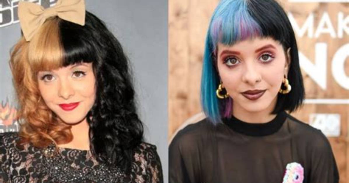 Melanie Martinez's Plastic Surgery Journey
