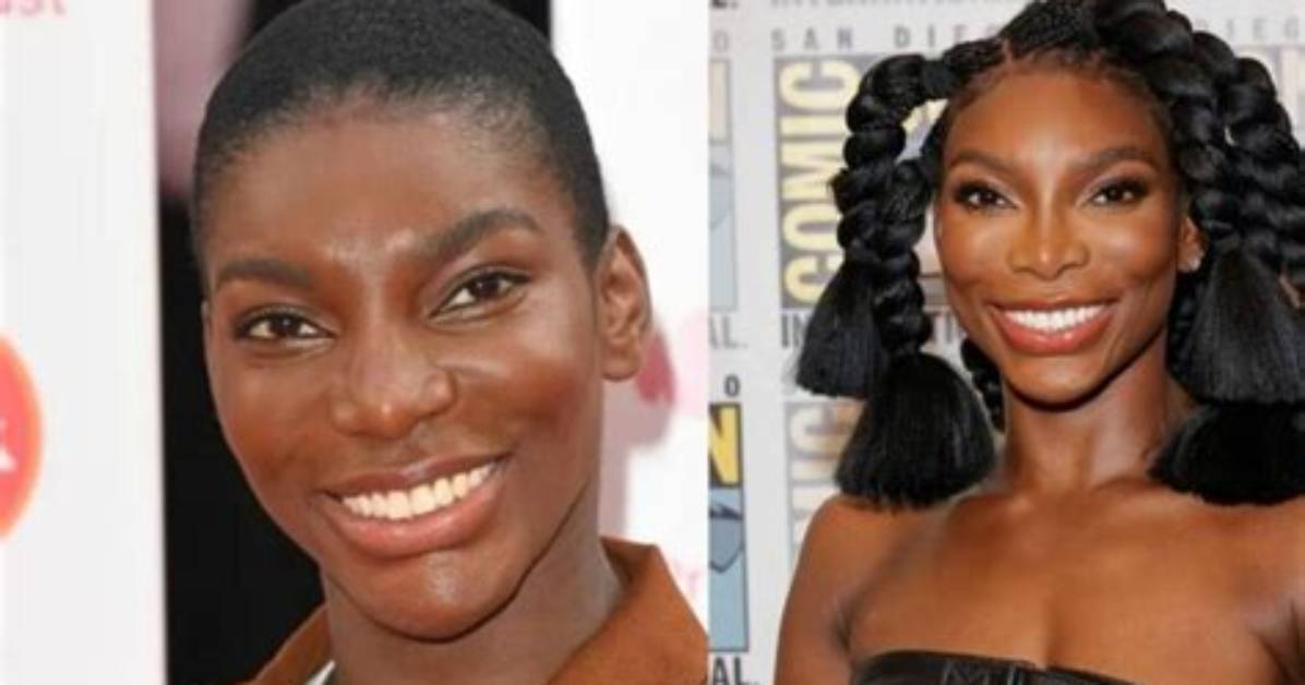 Michaela Coel's Fibroid Surgery Journey