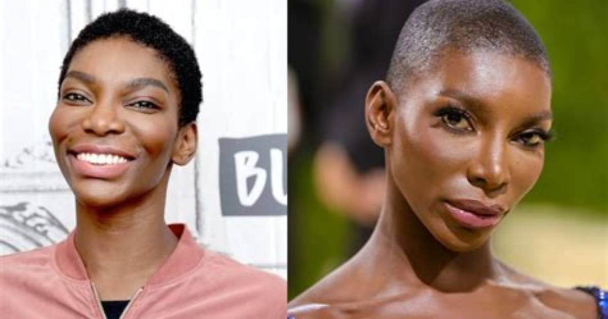 Michaela Coel's Plastic Surgery Journey