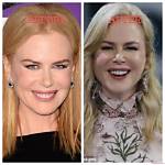 Nicole Kidman's Timeless Beauty: the Facelift Debate