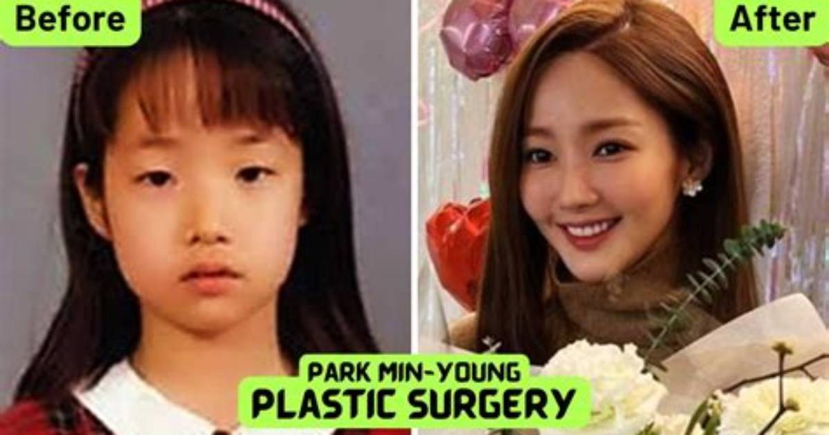 Park Min-Young's Transformation: Before and After Stardom