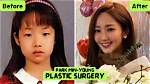 Park Min-Young's Transformation: Before and After Stardom