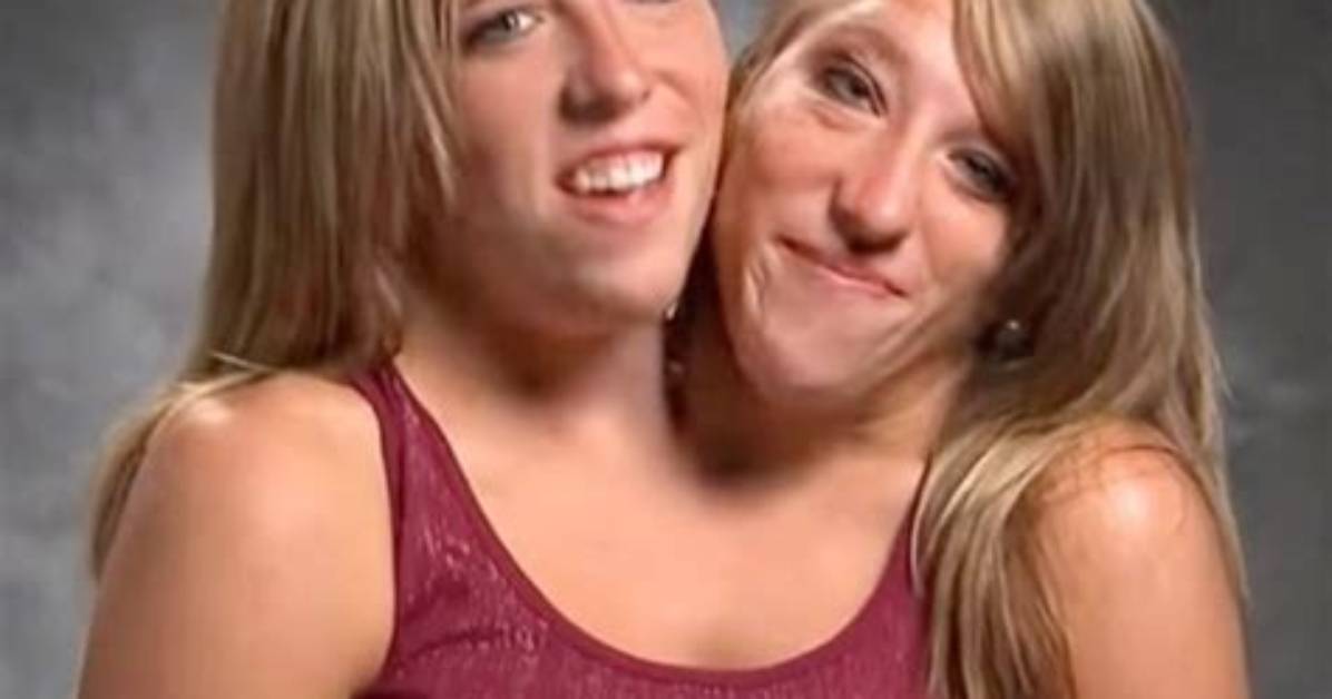 Remembering the Lives of Conjoined Twins Abby and Brittany