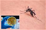 Researchers Use Mosquitoes on People to Test New Malaria Vaccine